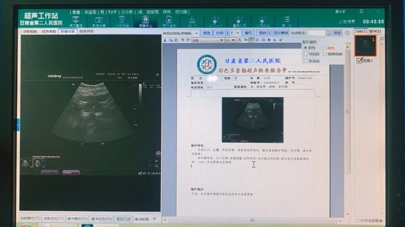肿瘤基因检测结果解读：准确吗？揭秘检测背后的科学原理
